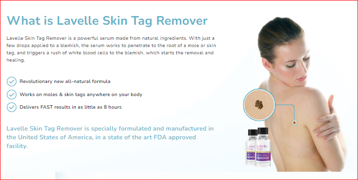 Lavelle Skin Tag Remover
